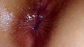 Marvels Experience Returns with Hardcore Rectal Exam